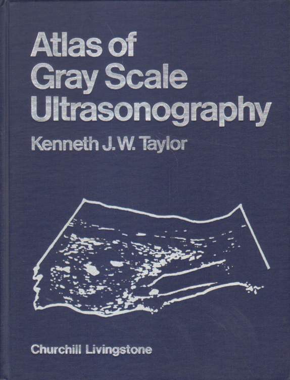 Atlas of Gray Scale Ultrasonography.