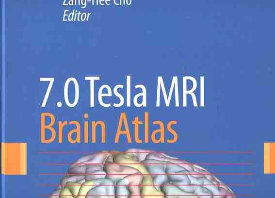 7.0 Tesla MRI brain atlas - in-vivo atlas with cryomacrotome correlation. first Edition