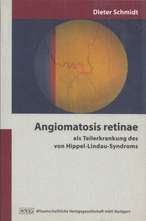 Angiomatosis retinae als Teilerkrankung des von Hippel-Lindau-Syndroms. Mit 22 Abb. u. 12 Tab. - Schmidt, Prof. Dr. Dieter