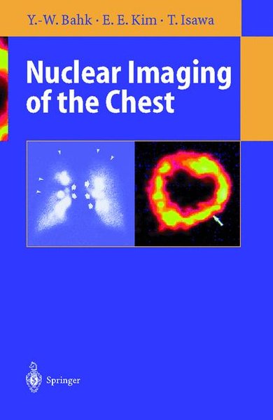 Nuclear imaging of the chest.
