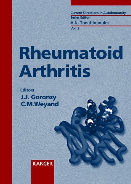Goronzy, Jrg and C. M. Weyand:  Rheumatoid arthritis - 14 tables. (=Current directions in autoimmunity ; Vol. 3). 