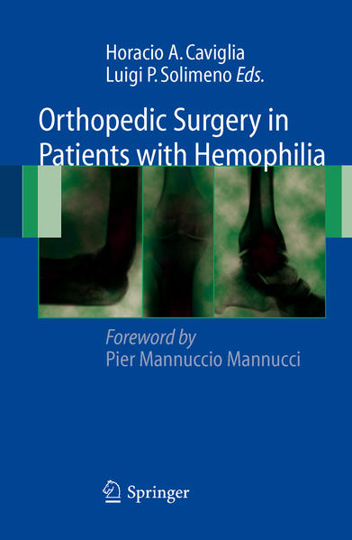 Orthopedic surgery in patients with hemophilia. - Caviglia, Horacio A. (Ed.)