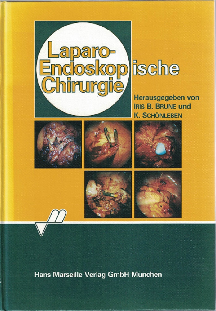 Schnleben, K. und I.B. Brune (Hrsg.)::  Laparo-endoskopische Chirurgie. 
