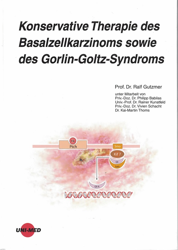 Konservative Therapie des Basalzellkarzinoms sowie des Gorlin-Goltz-Syndroms.