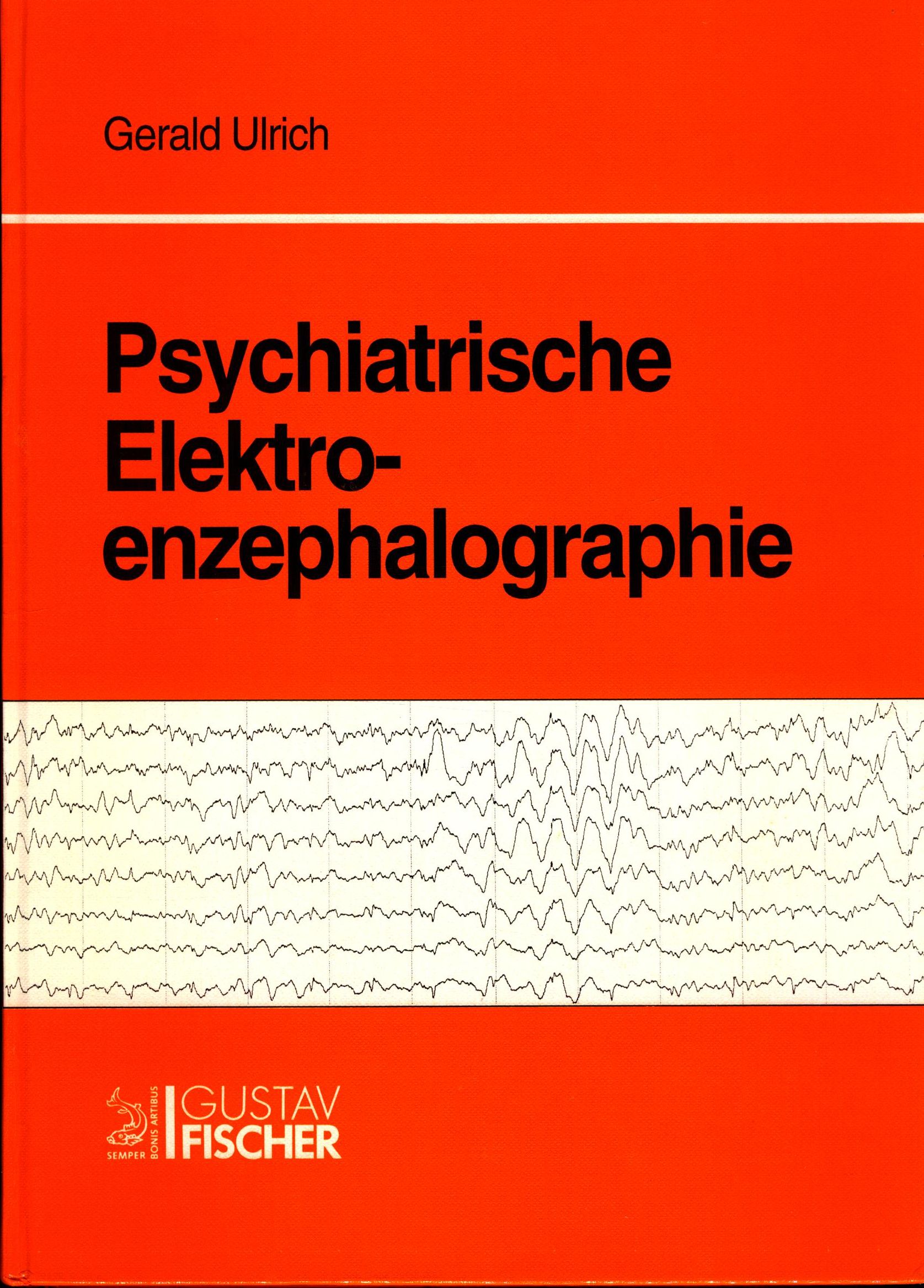 Psychiatrische Elektroenzephalographie Mit 9 Tabellen - Ulrich, Gerald