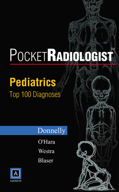 Pediatrics: Top 100 Diagnoses (PocketRadiologist S.) - Donnelly Lane, F., M. O`Hara Sara  und J. Westra Sjirk