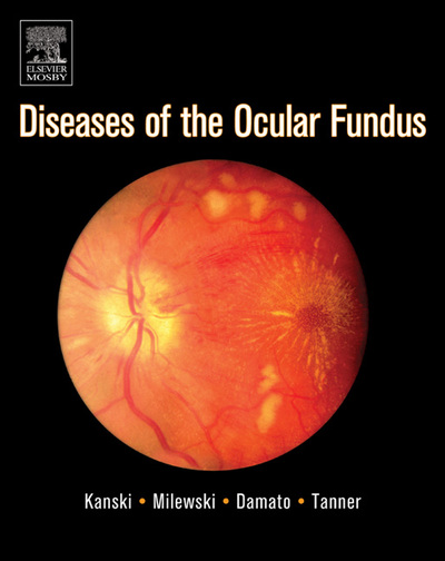 Diseases of the Ocular Fundus - Kanski,  Jack J.,  Stanislaw A. Milewski  und  Bertil E. Damato