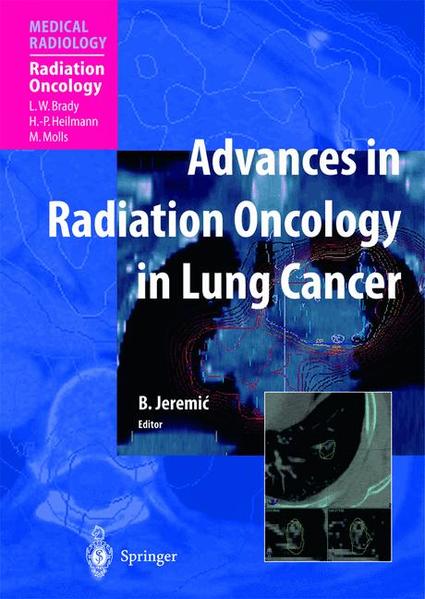 Advances in Radiation Oncology in Lung Cancer - Jeremic, Branislav, L.W. Brady  und H.-P. Heilmann