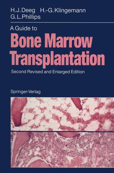 A Guide to Bone Marrow Transplantation  2nd rev. and enlarged ed. - Deeg, H.Joachim, Hans-Georg Klingemann  und Gordon L. Phillips