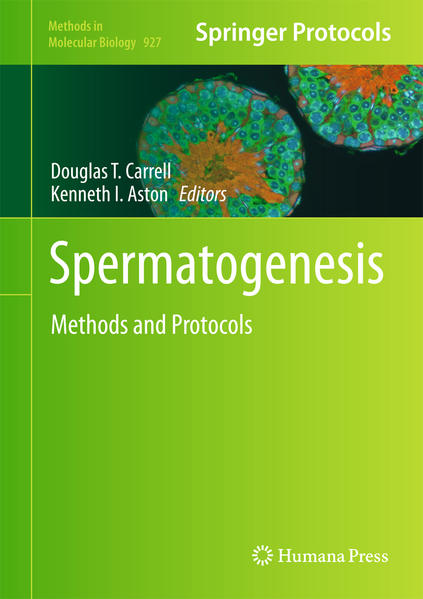 Spermatogenesis Methods and Protocols - Barnard, Lori und Kenneth I. Aston