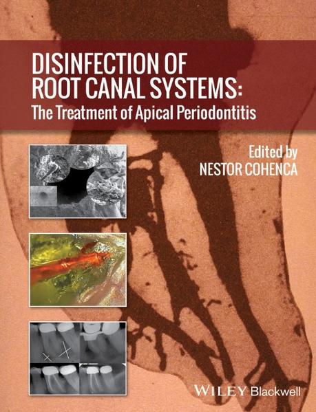 Disinfection of Root Canal Systems The Treatment of Apical Periodontitis - Cohenca, Nestor