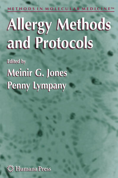 Allergy Methods and Protocols - Jones, Meinir G. und Penny Lympany