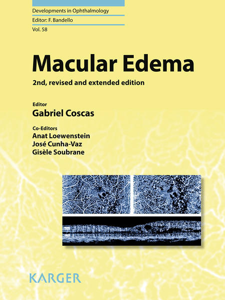Macular Edema - Coscas, G., A. Loewenstein  und J. Cunha-Vaz
