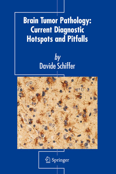 Brain Tumor Pathology: Current Diagnostic Hotspots and Pitfalls - Schiffer, Davide