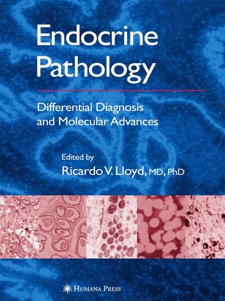Endocrine Pathology Differential Diagnosis and Molecular Advances 2004 - Lloyd, Ricardo V.
