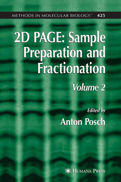 2D PAGE: Sample Preparation and Fractionation Volume 2 - Posch, Anton