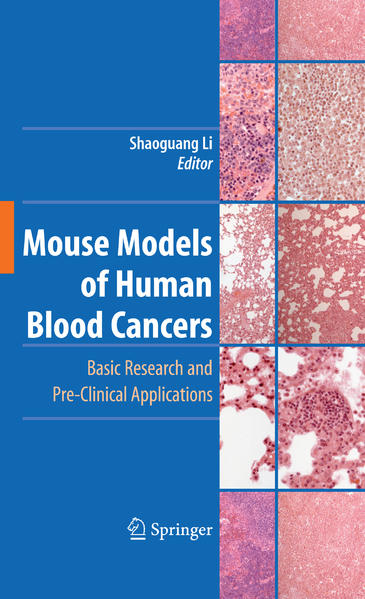Mouse Models of Human Blood Cancers Basic Research and Pre-clinical Applications - Li, Shaoguang