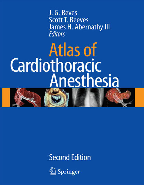 Atlas of Cardiothoracic Anesthesia - Reves, J. G., Scott Reeves  und  Abernathy, III, James H.
