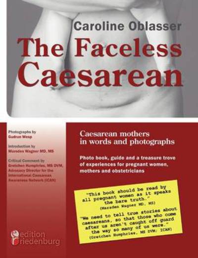 The Faceless Caesarean - Caesarean mothers in words and photographs. Photo book, guide and a treasure trove of experiences for pregnant women, mothers and obstetricians - Oblasser, Caroline